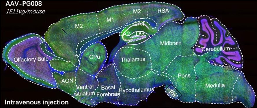 AAV Case 2