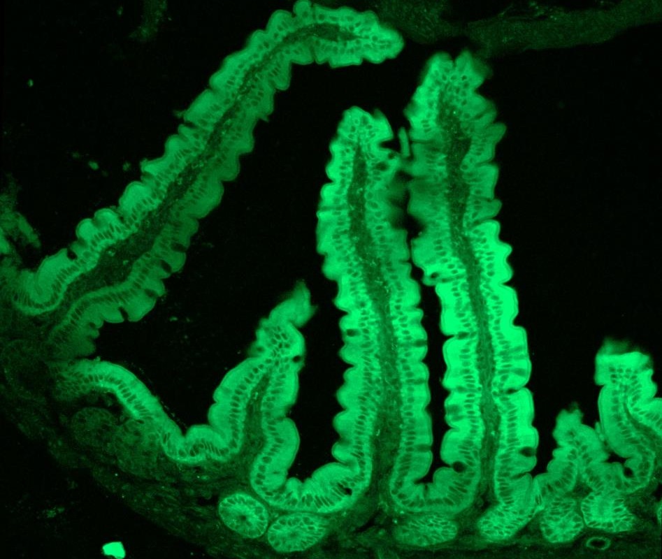 LNP+EGFP mRNA