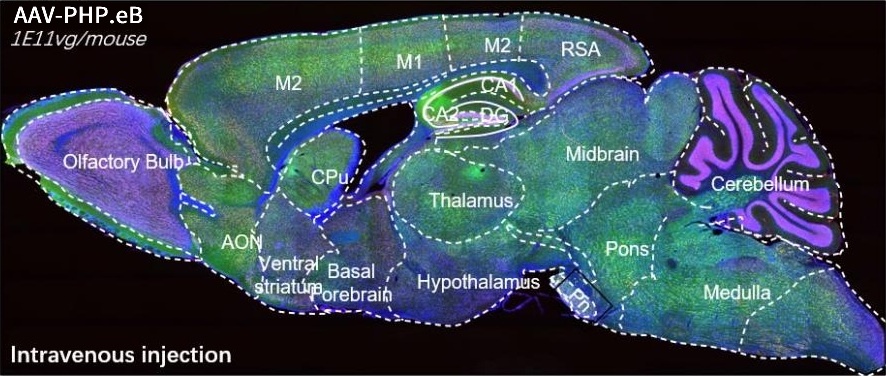 AAV-Case-1