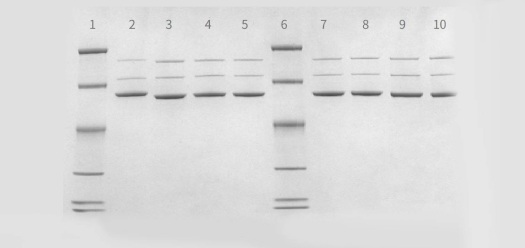 AAV purity analysis