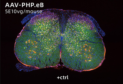 AAV-PHP.eB