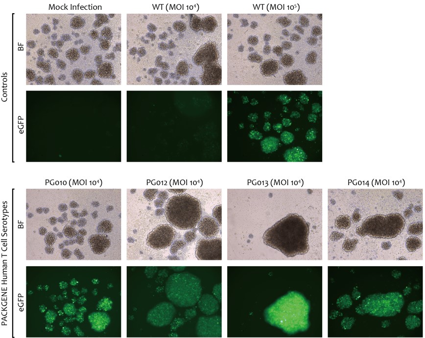 Infection of Quiescent Primary Human T Cells with Novel PackGene AAV6 Serotypes